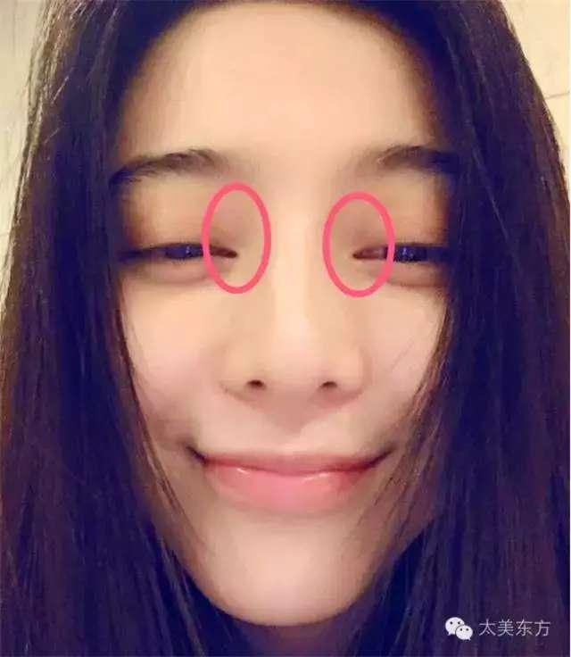 哪些女明星开过眼角的,揭秘开眼角的女明星美丽蜕变之路